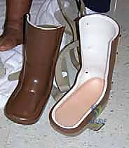 صورة توضيحية لـ تثبيت القدم السكرية شاركو جراحيًا: استعادة الوظيفة ومنع البتر مع الأستاذ الدكتور محمد هطيف