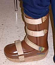 استخدام الأحذية الطبية المخصصة لحماية القدم مدى الحياة