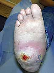 الأستاذ الدكتور محمد هطيف أثناء التقييم الجراحي