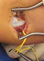 الفحص السريري وتقييم مدى الحركة