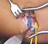 متابعة المريض بعد العملية