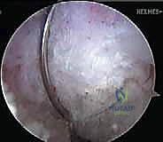 التخطيط الجراحي لإعادة البناء