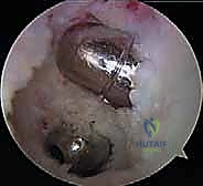 الفحص السريري للركبة