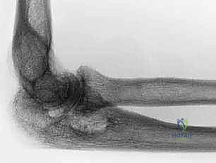 تخطيط العلاج التحفظي مقابل الجراحي