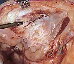 التخطيط المسبق وصور الأشعة