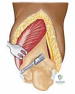 اختبار حركة المفصل الجديد