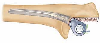 تقييم الحالة السريرية للمرفق