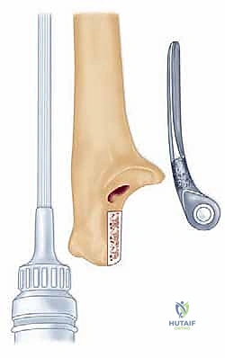 تحضير المريض في غرفة العمليات