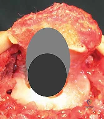 التأكد من التثبيت النهائي