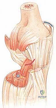 صورة توضيحية لـ إعادة بناء الزاوية الخلفية الوحشية للركبة
