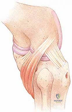 صورة توضيحية لـ إعادة بناء الزاوية الخلفية الوحشية للركبة: دليل شامل للمرضى مع الأستاذ الدكتور محمد هطيف