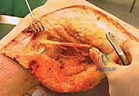 تفاصيل الطبقات العميقة والأربطة الحيوية