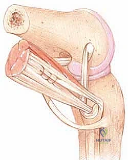 تحديد درجات الإصابة وخيارات العلاج