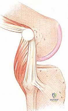 إجراء الفحوصات السريرية المتقدمة مثل Dial Test