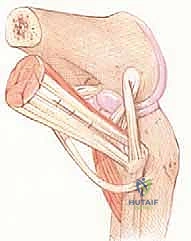 التشخيص الدقيق عبر التصوير بالرنين المغناطيسي