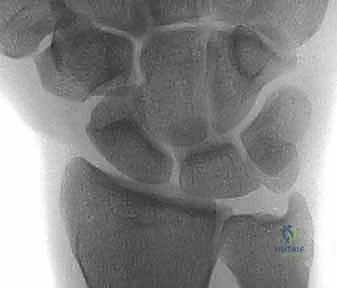 وصف طبي دقيق للمريض واختلال المحاذاة