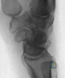 صورة للأدوات الجراحية أو التخطيط الجراحي