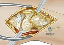 تأكيد الرد الدقيق