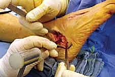 اختبارات الحركة والمرونة للقدم