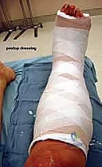 تطور التشوه مع مرور الوقت