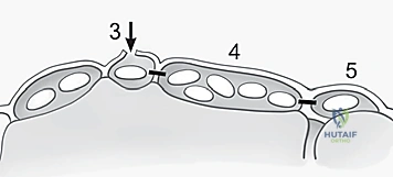 إصلاح وتمتين رباط الرسغ الهلالي الثلاثي: حلول متقدمة لآلام الرسغ المزمنة مع الأستاذ الدكتور محمد هطيف