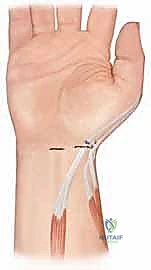 الفحص السريري لليد وتقييم التشوه