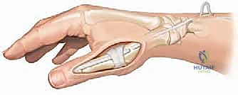 تصنيف التشوه وصور الأشعة