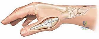 التشريح الدقيق لعضلات اليد والإبهام