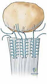 التشخيص السريري والتصوير الشعاعي لتمزق وتر الرضفة