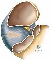 وصف طبي دقيق لتشريح الجزء العلوي الإنسي