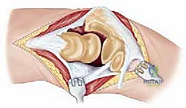 الأعراض السريرية لمشاكل الكوع