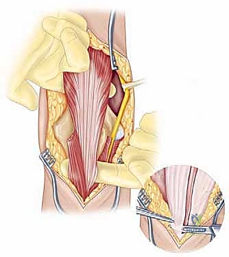 الأشعة المقطعية والتخطيط الجراحي ثلاثي الأبعاد
