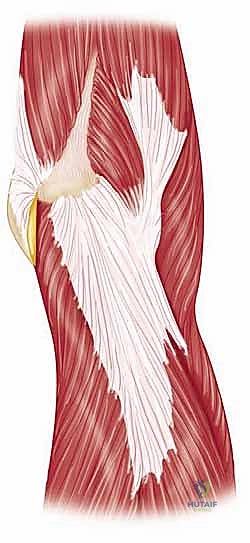 صورة طبية: إعادة بناء مفصل الكوع المعقد بعد الإصابات: دليلك الشامل مع الأستاذ الدكتور محمد هطيف في صنعاء