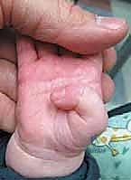 وصف طبي دقيق للمريض