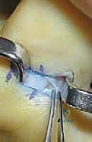 التأكد من الانزلاق السلس للوتر بعد التحرير