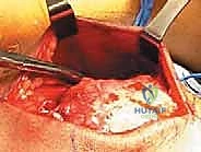 استخدام أحدث التقنيات الطبية في جراحة العظام والمفاصل