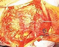 التشخيص الدقيق بالأشعة السينية والرنين المغناطيسي