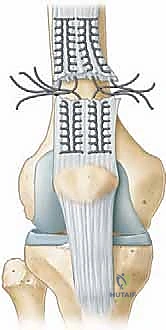 الأستاذ الدكتور محمد هطيف أثناء إجراء تدخل جراحي دقيق