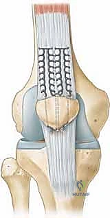 تقييم الأستاذ الدكتور محمد هطيف لحالة الركبة