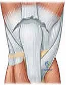 صورة توضيحية لـ إصلاح تمزق الوتر الرباعي للركبة: دليل شامل للمرضى مع الأستاذ الدكتور محمد هطيف في صنعاء