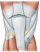 خطوات خياطة الوتر الرباعي بتقنية كراكو