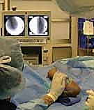 صورة توضيحية لـ كسر عظم العضد فوق اللقمة عند الأطفال الرد المغلق والتثبيت بالأسلاك مع الأستاذ الدكتور محمد هطيف