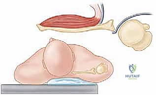 التشخيص الدقيق بالأشعة المقطعية ثلاثية الأبعاد