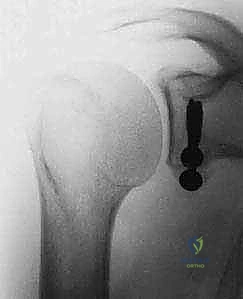 استخدام أحدث التقنيات الجراحية في صنعاء