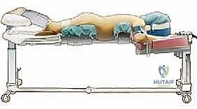 تفاصيل الاستئصال الميكروسكوبي للغضروف