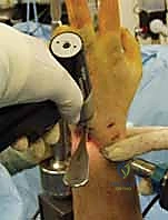 تقييم التئام العظم في زيارات المتابعة الدورية