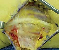 استخدام أجهزة التصوير الإشعاعي (C-Arm) داخل غرفة العمليات