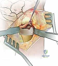 العودة للحياة الطبيعية بفضل الرعاية الطبية الفائقة