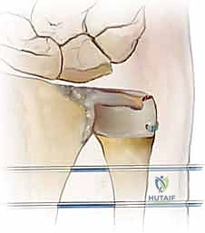 توضيح حركة الكب والبسط للساعد السليم