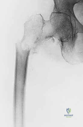العناية ما بعد الجراحة